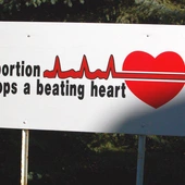 Teksas wprowadza zakaz aborcji po wykryciu bicia serca dziecka