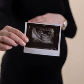 Wyspy Owcze: nowa ustawa o nieograniczonym dostępie do aborcji