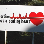Teksas: tymczasowo zablokowano prawo ograniczające aborcję