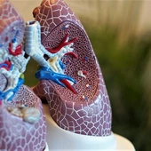 Pulmonolog: Pacjenci po ciężkim przebiegu COVID-19 mogą stać się inwalidami oddechowymi