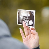 Paweł Ozdoba: Środowiska lewicowe straszą „rejestrem ciąż”, żeby forsować legalizację aborcji