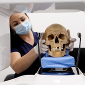 Zęby ludzi średniowiecza – mniej próchnicy niż u współczesnych