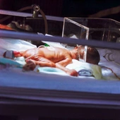 Chłopiec urodził się w 23 tygodniu ciąży, kiedy możliwa jest aborcja. Właśnie obchodził pierwsze urodziny