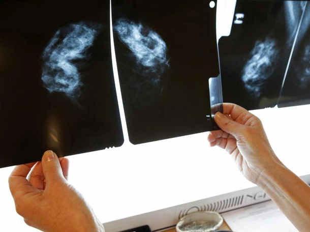 Onkolog: pandemia zaciągnęła w onkologii dług zdrowotny, z którym długo będziemy się borykać