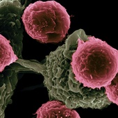 Innowacyjna strategia leczenia nowotworów odkryta przez naukowców z UJ