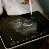 Aborcja w 26. tygodniu ciąży. Obrońcy życia piszą do dyrekcji szpitala w Oleśnicy