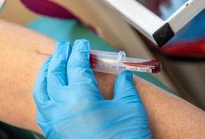 Zwykłe badanie krwi może wskazać ryzyko zawału