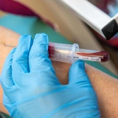 Zwykłe badanie krwi może wskazać ryzyko zawału